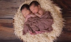 Bayi Kembar Siam Dempet Bokong Asal Tulungagung Jalani Pemisahan Saat Berusia 8-12 Bulan