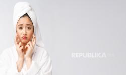 Kulit Berminyak <em>Enggak</em> Butuh Pelembap? Dermatologis: Salah Kaprah