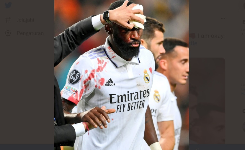 @ToniRuediger