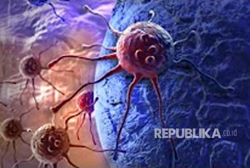 Ilmuwan memanipulasi makrofag dari peradangan untuk membunuh sel kanker. Gambar: Republika.co.id