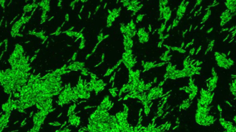 Bakteri berbentuk batang ini dipastikan melahap dan memecah kolesterol (dalam warna hijau)/Ahmed Mohamed
