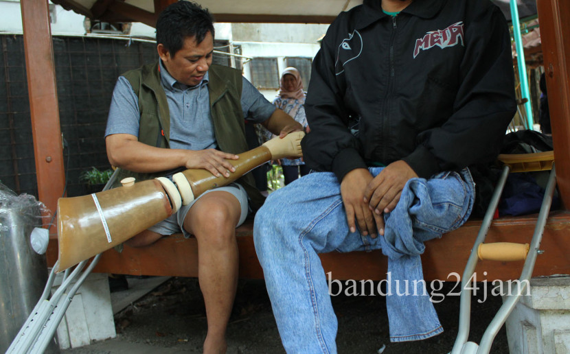 Disabilitas memakai kaki palsu saat acara pemberian 16 kaki palsu kepada warga disabilitas Kota Bandung, di Pendopo Kota Bandung, Selasa (27/8/2024). Foto: Edi Yusuf