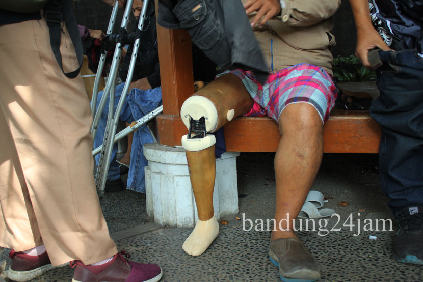 Disabilitas memakai kaki palsu saat acara pemberian 16 kaki palsu kepada warga disabilitas Kota Bandung, di Pendopo Kota Bandung, Selasa (27/8/2024). Foto: Edi Yusuf