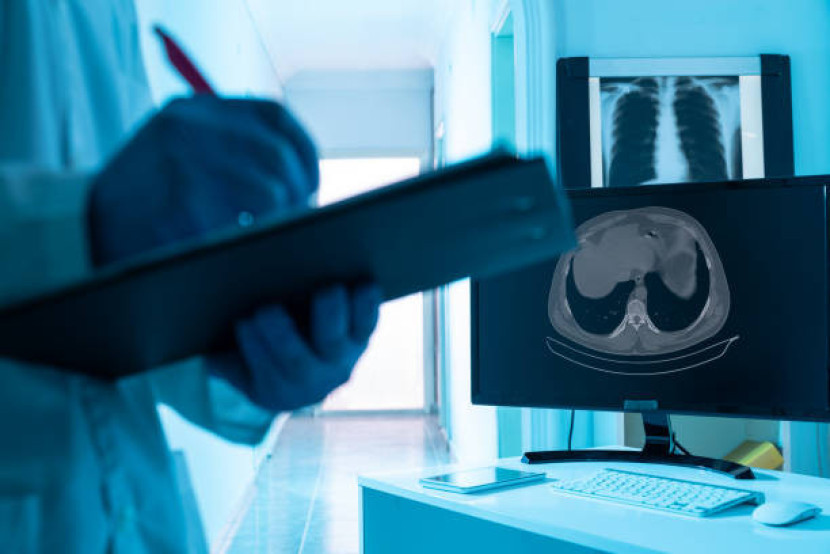 Ilustrasi hasil pencitraan pemeriksaan pasien oleh radiografer. Sumber: iStock