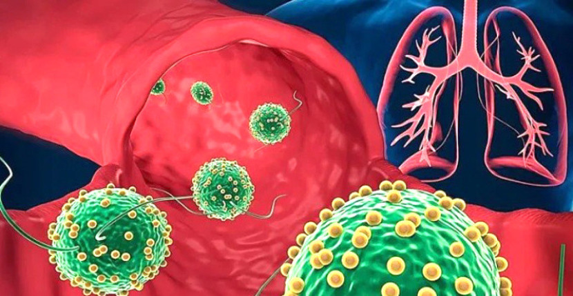 Ilustrasi mikrorobot yang memasuki paru-paru untuk mengobati pneumonia/Professor Joseph Wang lab.