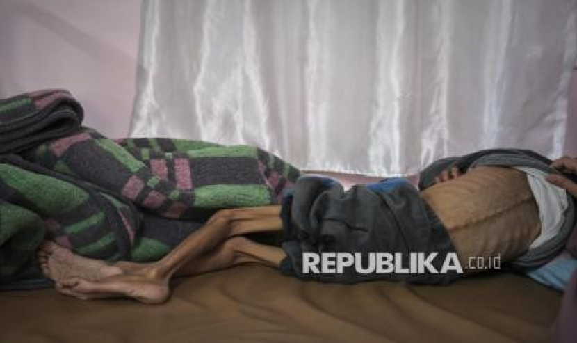 Osama al-Raqab (5th), salah satu korban kekurangan gizi mendapat perawatan di rumah sakit Nasser, Khan Younis, Jalur Gaza, awal Mei lalu.