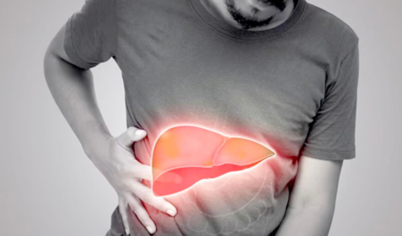 Foto ilustrasi pengidap penyakit Hepatitis. (Foto: Dok RUZKA INDONESIA)