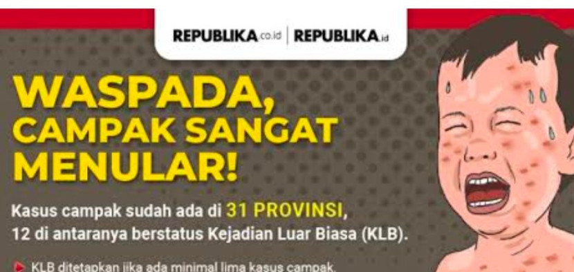 Waspada, campak sangat menular. (Foto: Dok REPUBLIKA)