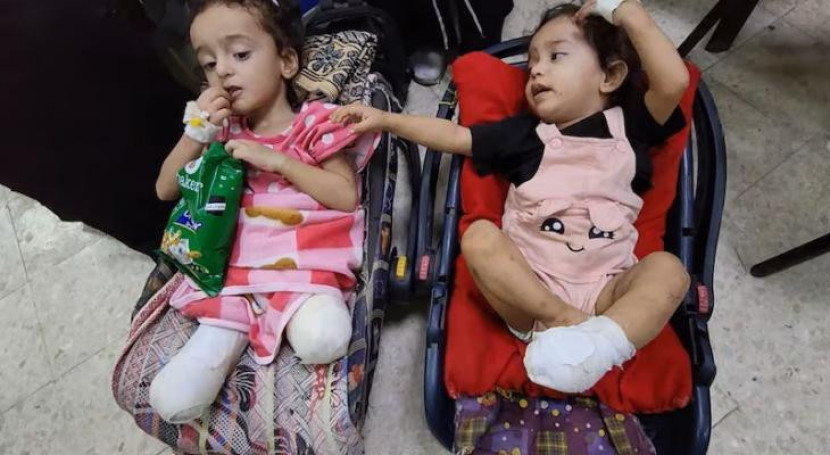 Anak-anak Gaza harus rela kehilangan anggota tubuhnya. (Days of Palestine)