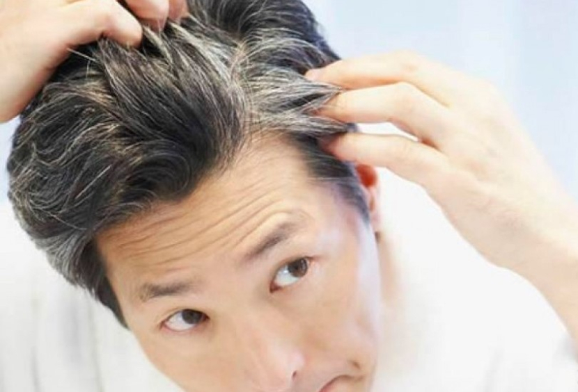 Riset: Rambut Beruban Bisa Kembali ke Warna Semula Setelah Pergi Liburan. (dok. republika)