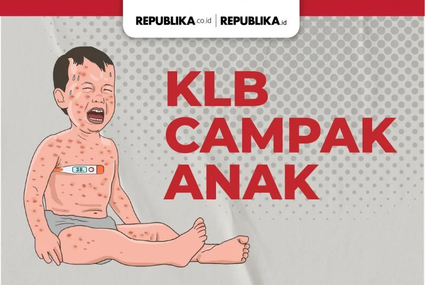 Sejumlah daerah dinyatakan KLB penyakit Campak. Ilustrasi : republika