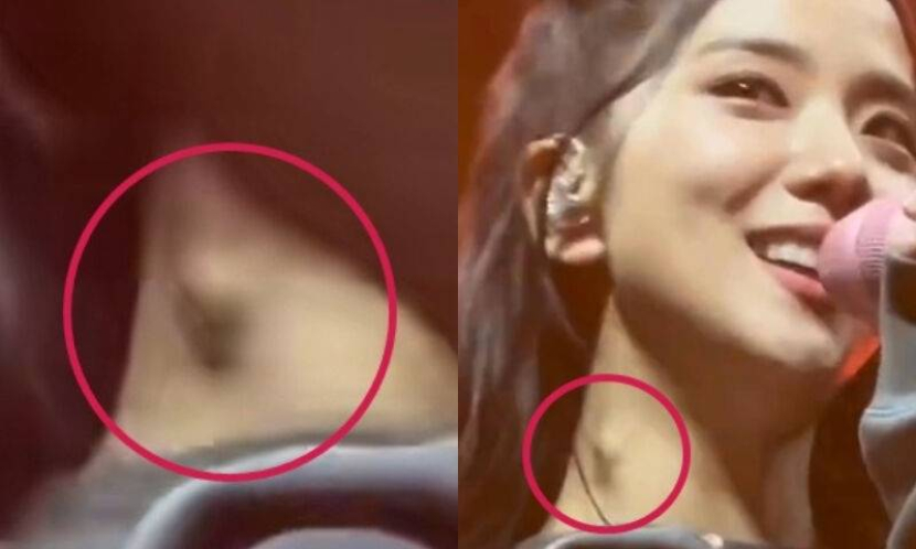 Sebuah potret menujukkan adanya benjolah pada leher Jisoo BLACKPINK. Foto yang viral ini membuat para penggemar khawatir dengan kesehatan Jisoo. Foto: Istimewa