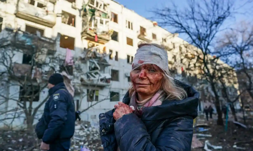 Wanita dengan wajah berdarah dan kepala diperban di kota  Kyiv, Ukraina
