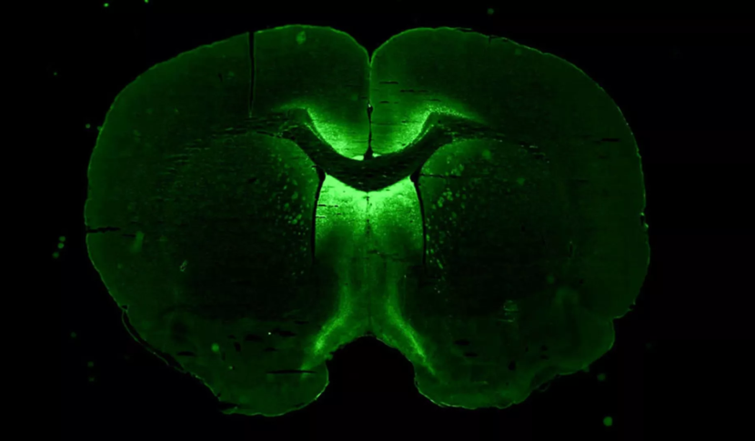 Gambar ini, diambil dalam percobaan yang dilakukan di Bumi, menunjukkan struktur 3D yang terbuat dari sel-sel otak yang tumbuh di laboratorium. Sel hijau bercahaya adalah neuron yang telah terpapar terapi gen baru, yang dirancang untuk membantu neuron menumbuhkan kembali kabel keluarnya, yang dikenal sebagai akson. Gambar: Axonis Therapeutics, Inc.