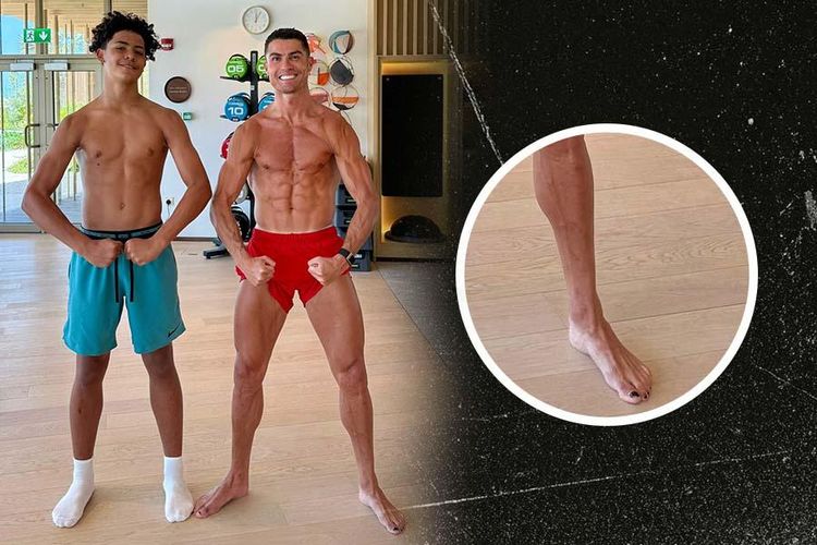 Kuku Cristiano Ronaldo Menghitam, Ternyata Teknik Umum Para Atlet
