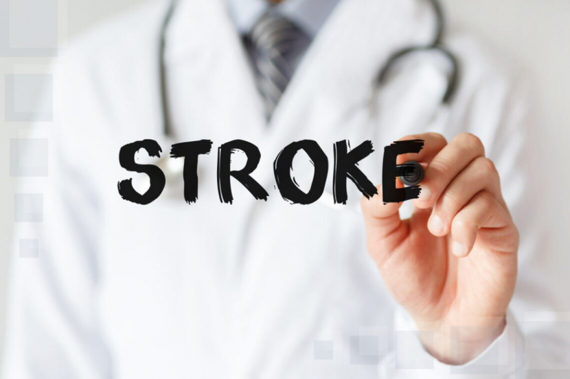 Pertolongan Pertama Pada Gejala Stroke Ringan Yang Bisa Diterapkan