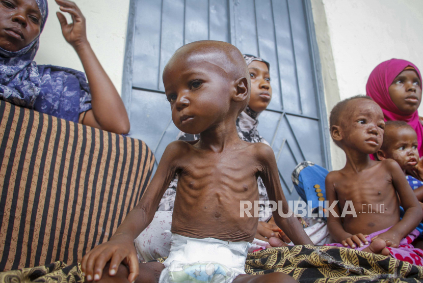 Stunting. Stunting is a condition in which a child's height is shorter than other children the same age due to prolonged malnutrition. (Republika)