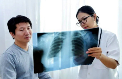 Alat AI Baru Bisa Membantu Deteksi Kanker Paru Empat Bulan Lebih Awal