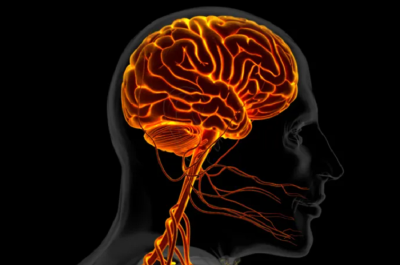 Gangguan Saraf Otak, dari Stroke sampai Bells Palsy: Apa Itu?