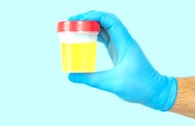 Ilmuwan Temukan Cara Mengubah Urine Jadi Bahan Pembentuk Tulang