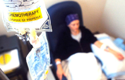 Begini Cara Kemoterapi Melawan Kanker
