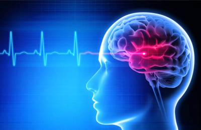 Apa Saja Pemicu Risiko Stroke pada Orang di Bawah Usia 50 Tahun?