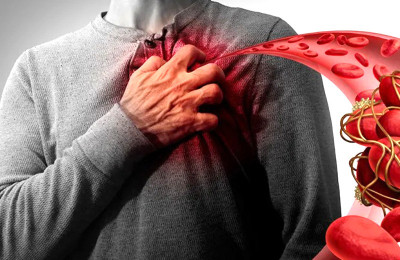 Ilmuwan Temukan Penyakit Pembekuan Darah Baru