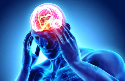Duh... Sakit Kepala Migrain Melipatgandakan Risiko Stroke