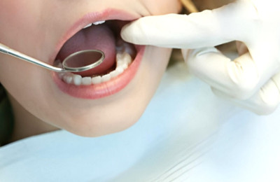 Kesehatan Mulut yang Buruk Bisa Meningkatkan Risiko Kanker Pankreas