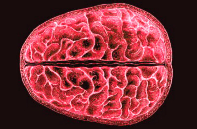 Ilmuwan Mengidentifikasi Perubahan Struktural di Seluruh Otak Selama Menstruasi