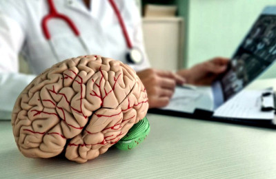 Prosedur Sederhana Dapat Mengurangi Risiko Stroke Hingga 50 Persen