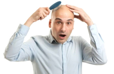 Obat Ini Efektif untuk Rambut Rontok Pria, Namun Efek Sampingnya Bisa Serius