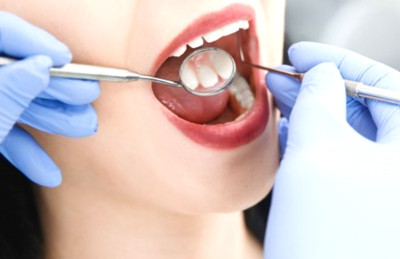 Gigimu Bermasalah? Waspadalah, Risiko Stroke Mengintai